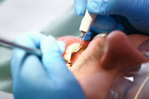 Best Emergency Treatment for Dental Infections or Abscesses in Cumings, TX