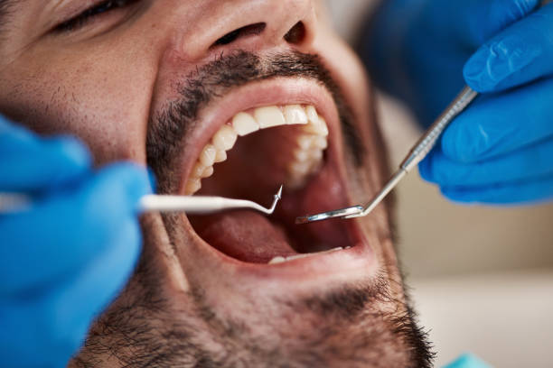 Best Urgent Care for Lost Fillings or Crowns in Cumings, TX
