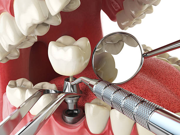 Best Pediatric Emergency Dentist in Cumings, TX