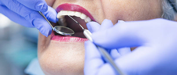 Best Emergency Tooth Extraction in Cumings, TX