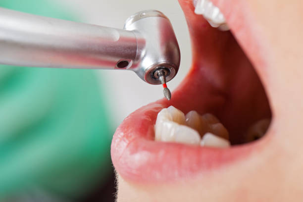 Best Same-Day Emergency Dental Services in Cumings, TX